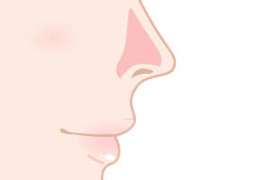 鼻の脱毛の範囲