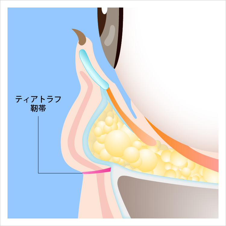 ティアトラフ靭帯の図解イラスト