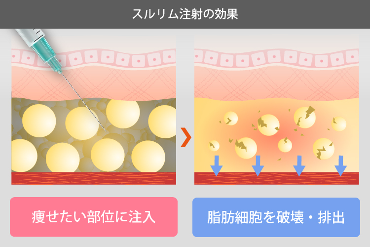 スルリム注射の効果のイラスト