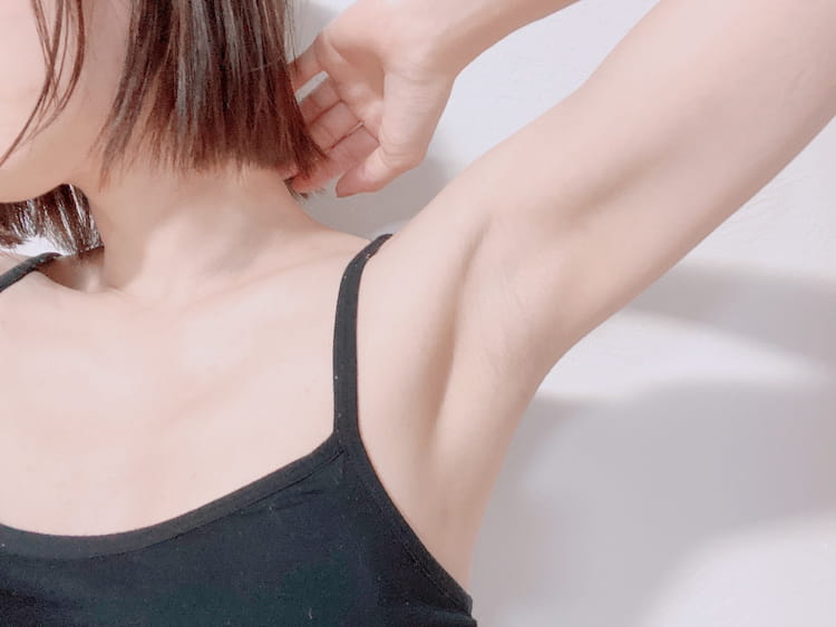 多汗症・わきが治療