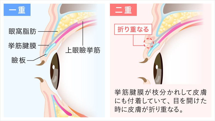 二重まぶたの仕組み