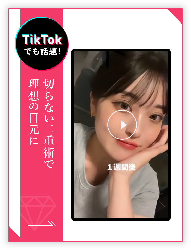 理想の二重を叶えるTCB二重術