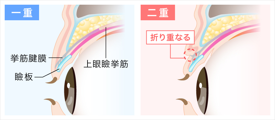 一重瞼と二重瞼の構造の違いのイラスト