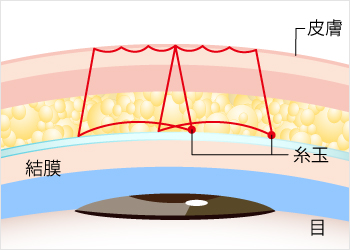 プレミアムエタニティ シークレットダブルのイラスト