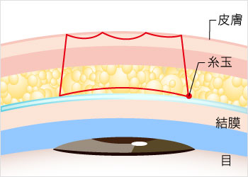 プレミアムエタニティ シークレットシングルのイラスト
