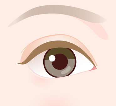 グラマラスライン形成（埋没法）の施術方法04