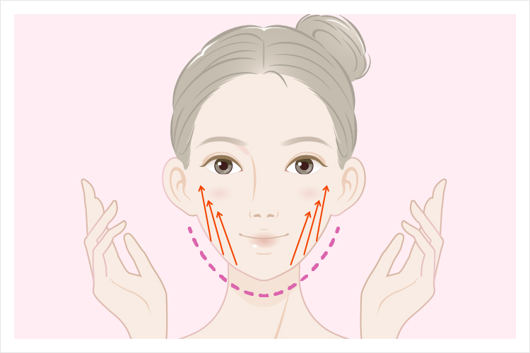 糸リフトの小顔効果のイラスト