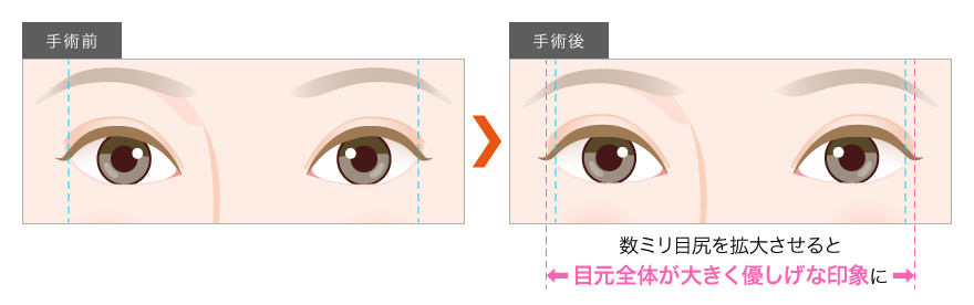 目の横幅を広げる効果のイラスト
