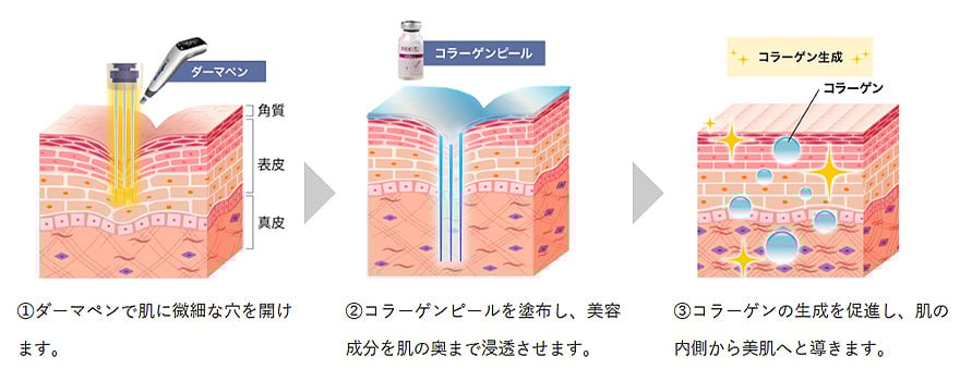 ヴェルベットスキンの仕組み