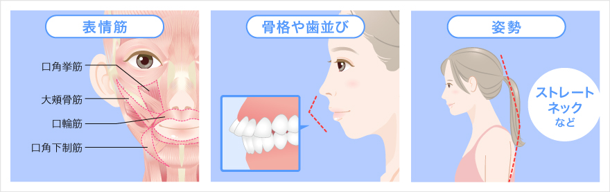 口角の形に影響する要素を説明するイラスト