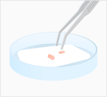 リジェネラ（RIGENERA）の治療方法1