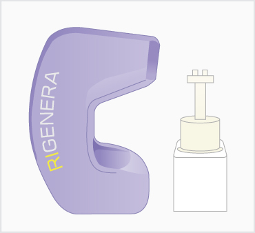 リジェネラ（RIGENERA）の治療方法2