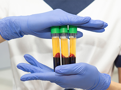 血漿層と赤血球層に分けられた血液のイメージ画像