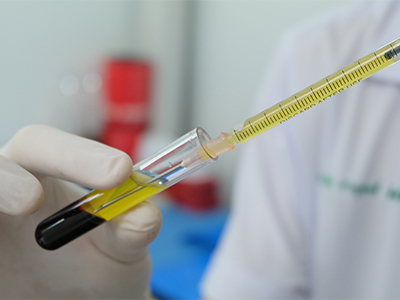 血漿層のみを抽出するイメージ画像