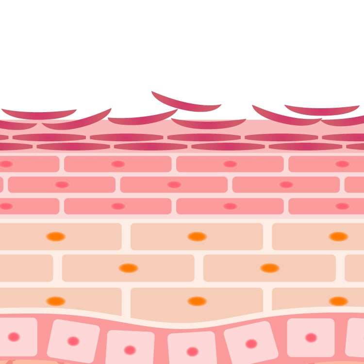 ケミカルピーリングの仕組み1