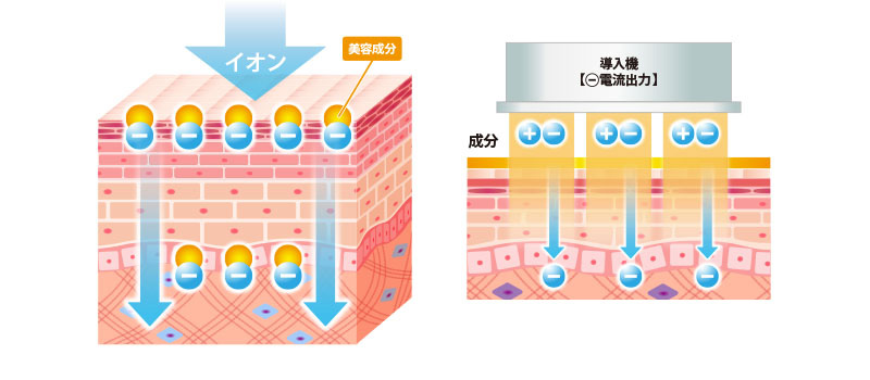 イオン導入の仕組みのイラスト