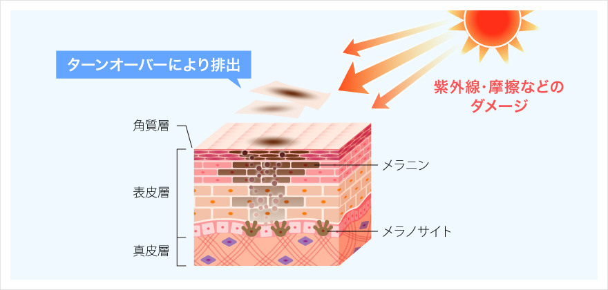 シミができる原因のイラスト