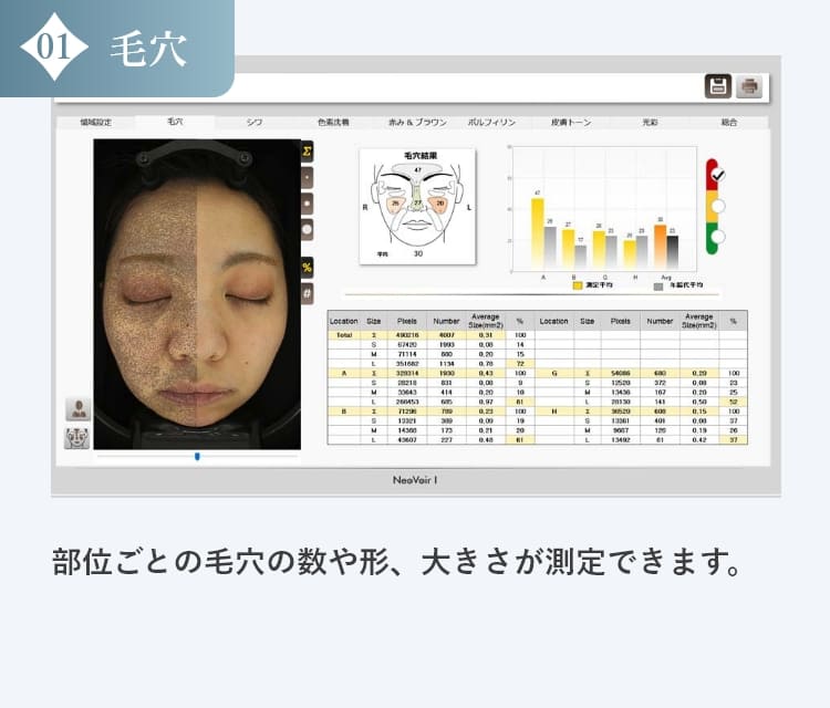 毛穴の診断結果