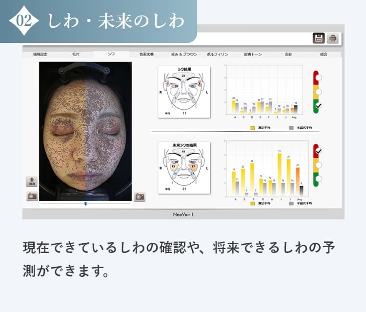 しわ・未来のしわの診断結果