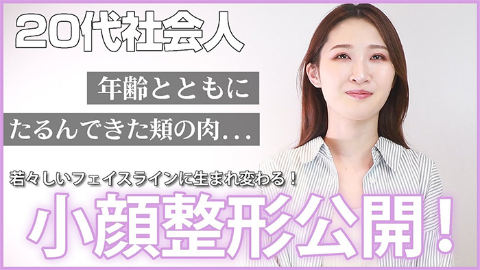 糸リフトの小顔整形に密着した動画サムネイル