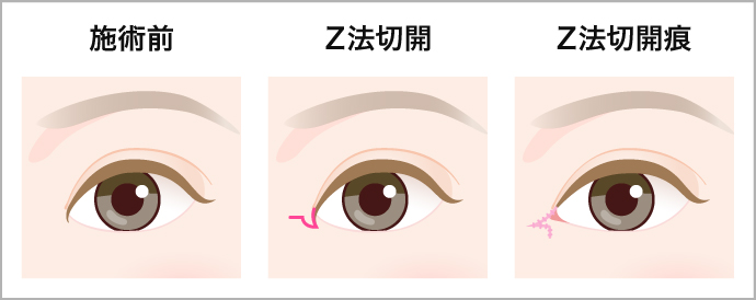 丸い 目頭 【目の人相学】目の大きさ・形・幅からわかる性格や特徴を徹底解説