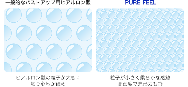 TCBのヒアルロン酸は粒子が小さくやわらかな感触、高密度で造形も良い