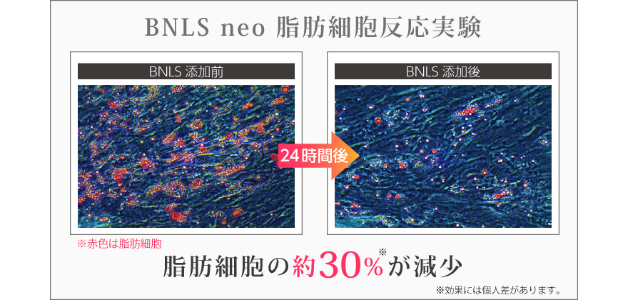 顔痩せクリニックの1day小顔ダイエット注射 美容整形なら東京中央美容外科 Tcb公式