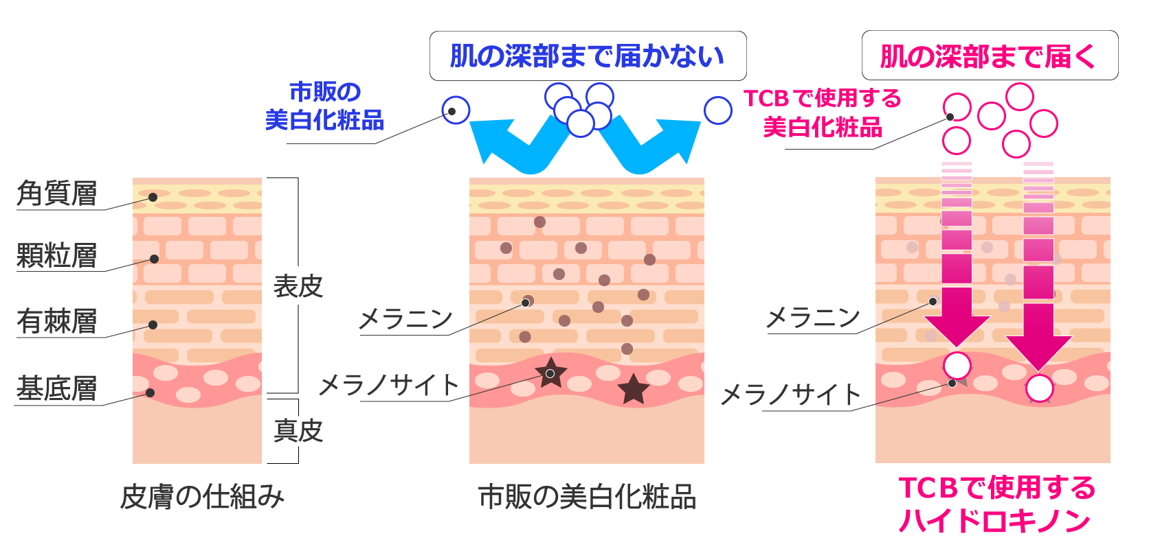 乳輪 乳頭の黒ずみ除去 最適な治療法で黒ずんだ乳首をピンク色に 美容整形なら東京中央美容外科 Tcb公式
