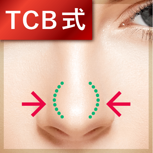 TCB式鼻先尖鋭術（だんご鼻解消）