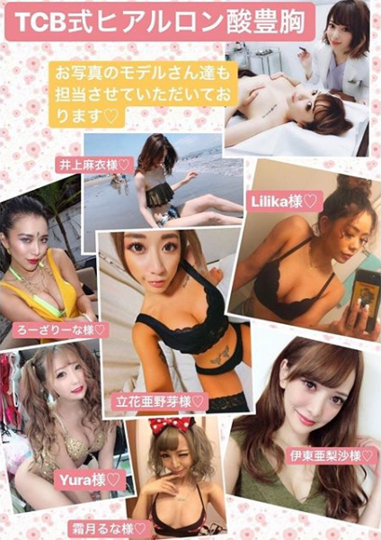 TCB式ヒアルロン酸豊胸術を行ったインフルエンサー様たち