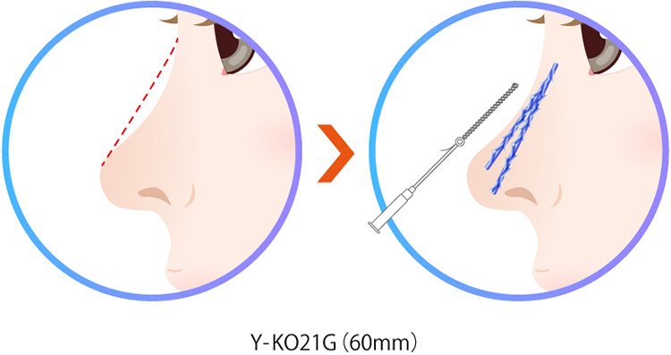 鼻筋を通すのに適した n-COGのY-KO（ワイコ）は21G（60mm）