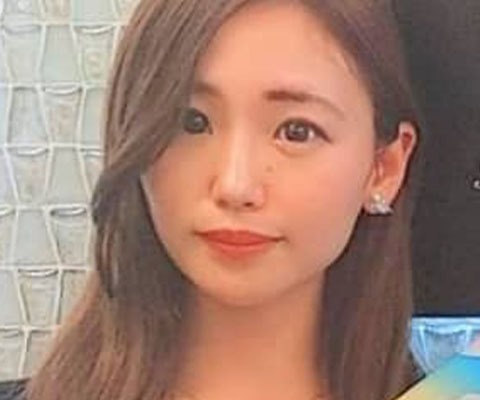 こみつじょう 美容整形なら東京中央美容外科 Tcb公式