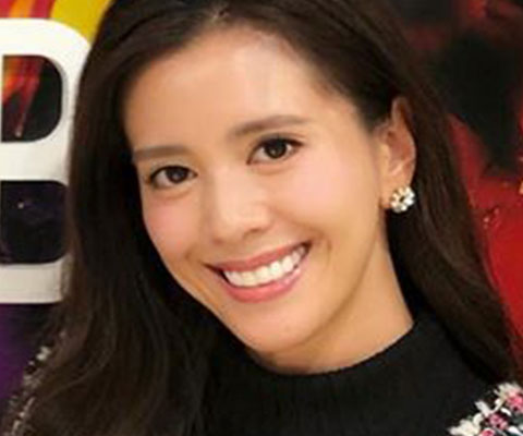 黒田麻理耶 美容整形なら東京中央美容外科 Tcb公式