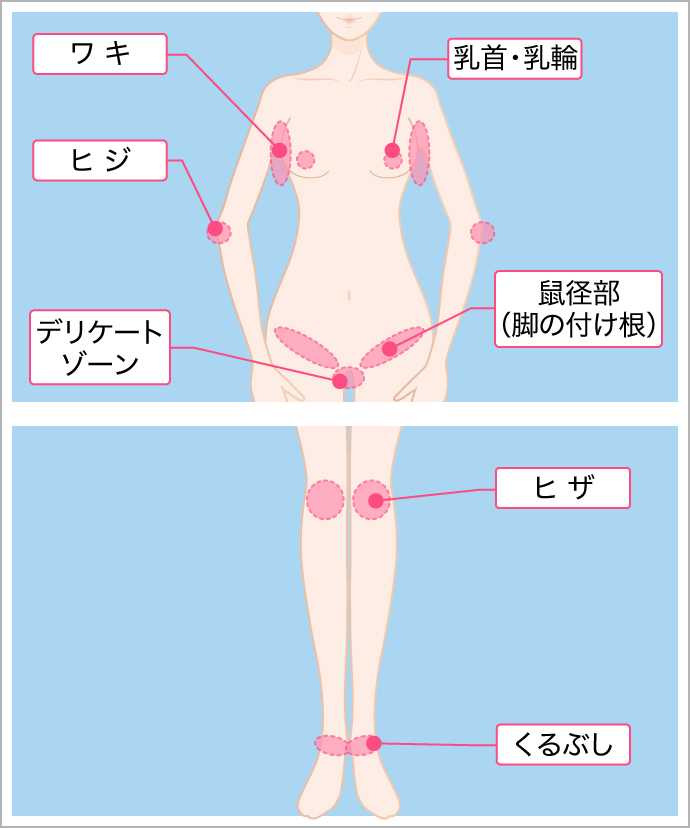 デリケートゾーンの黒ずみ改善に 皮膚科医推奨 ピンクインティメイト 美容整形なら東京中央美容外科 Tcb公式