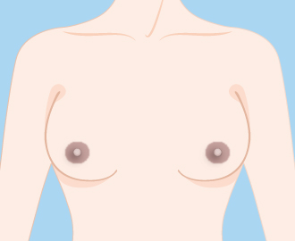 乳首の黒ずみのイラスト