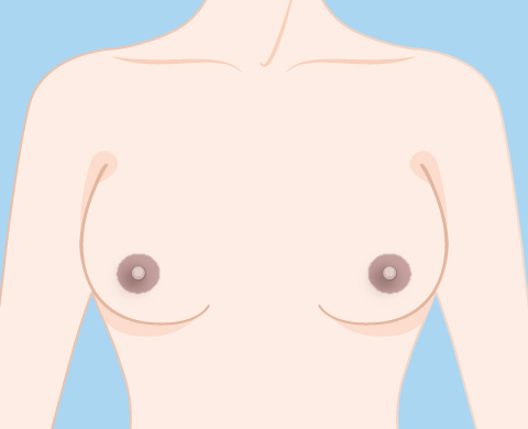 乳首の黒ずみのイラスト