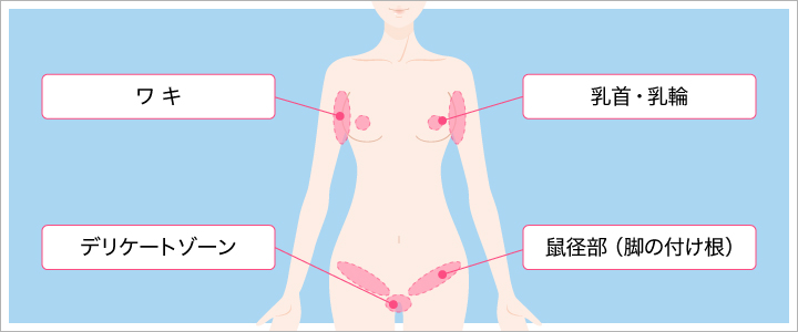 治療範囲のイラスト
