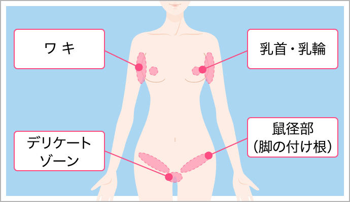 治療範囲のイラスト
