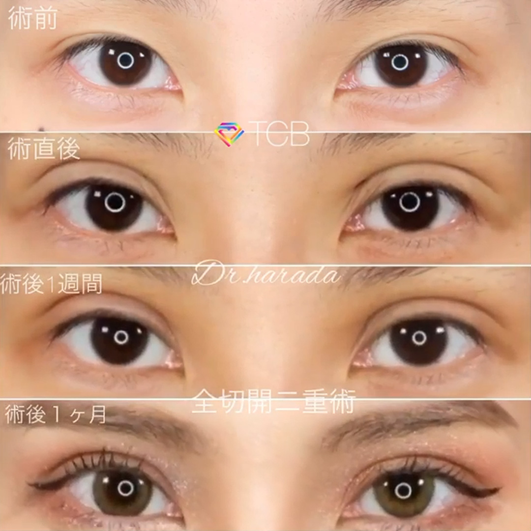 鼻整形の名医 原田浩光 美容整形なら東京中央美容外科 Tcb公式