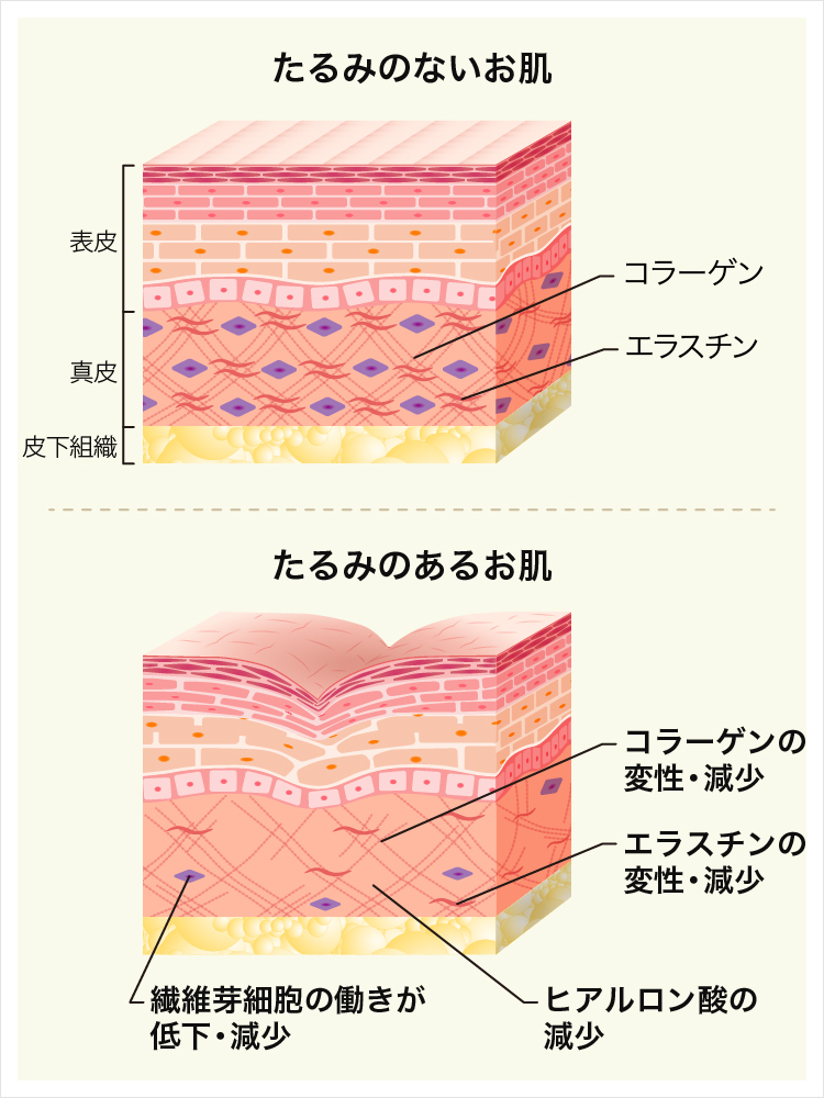 目の下のたるみがひどい原因 たるみ改善治療について 美容整形なら東京中央美容外科 Tcb公式