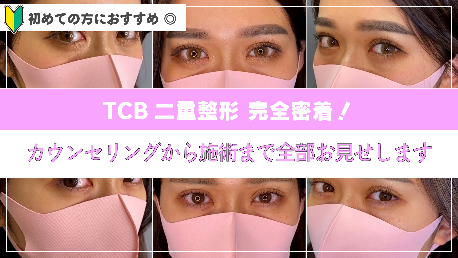 二重 ふたえ 整形 埋没法 腫れない二重 ふたえ 埋没法 1dayクイックアイ 美容整形なら東京中央美容外科 Tcb公式