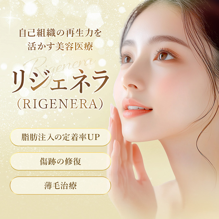 リジェネラ（RIGENERA）